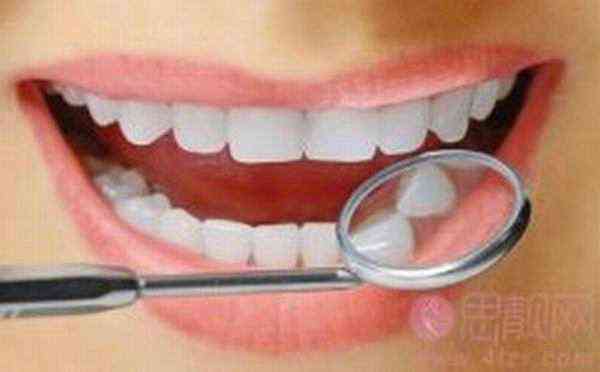 牙齿缺损如何进行功能修复