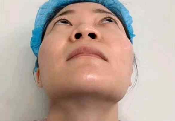 北京百达丽医疗美容怎么样？附医生信息介绍+下颌角术后果对比