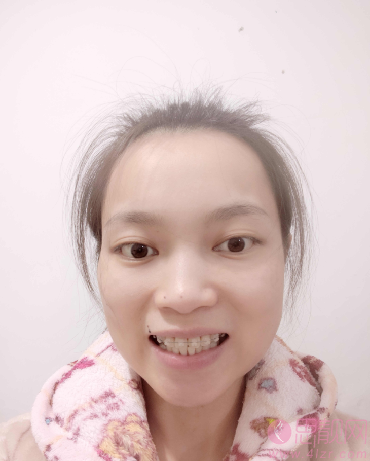 上海赛德口腔门诊部价格表公开+牙齿矫正前后效果对比