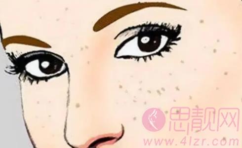 脸上长黄褐斑的原因有哪些？日常生活如何预防长斑呢？