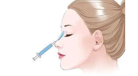 玻尿酸隆鼻副作用有什么.jpg