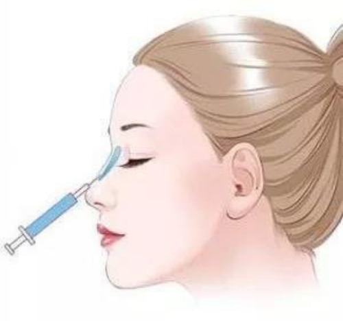 鼻子打玻尿酸能维持多久呢，鼻子打玻尿酸有后遗症吗？