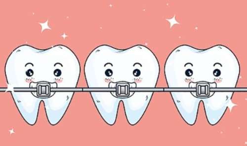 矫正牙齿的佳年龄是多少岁？效果怎么样？科普知识汇总