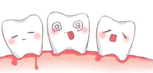 洗牙后牙缝变大正常吗？注意事项有哪些？